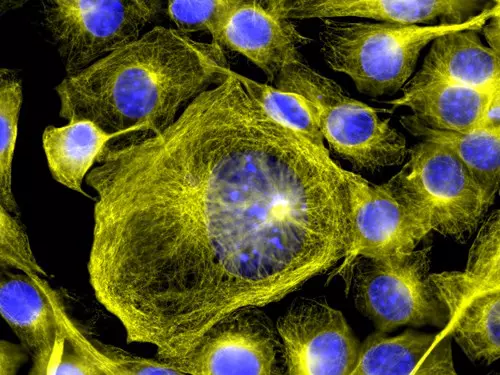 A mezenchim�lis �ssejtek szerepe a tumork�pz�d�sben