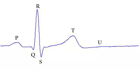 Az emberi EKG