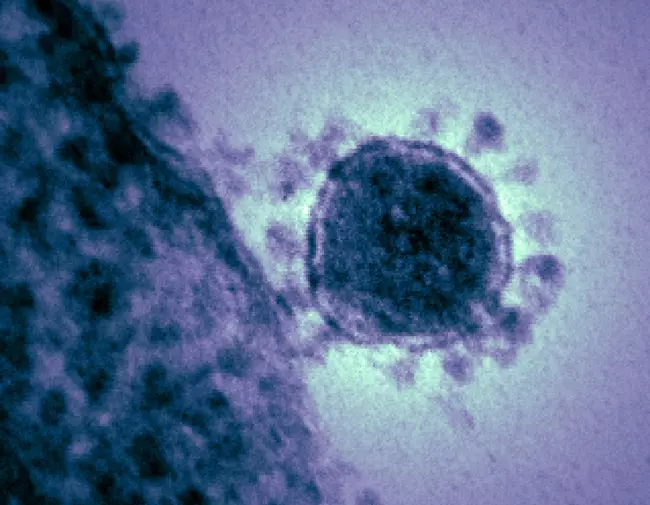 Humán koronavírus elektronmikroszkópos képe